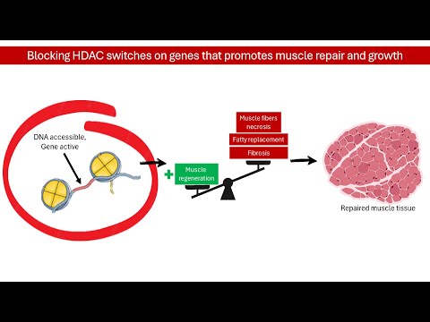 Duchenne Muscular Dystrophy (DMD) Hope: New Treatment - Givinostat Explained! │PHARMACOLOGY